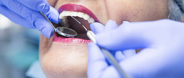 Best Broken or Chipped Tooth Repair in Covington, KY